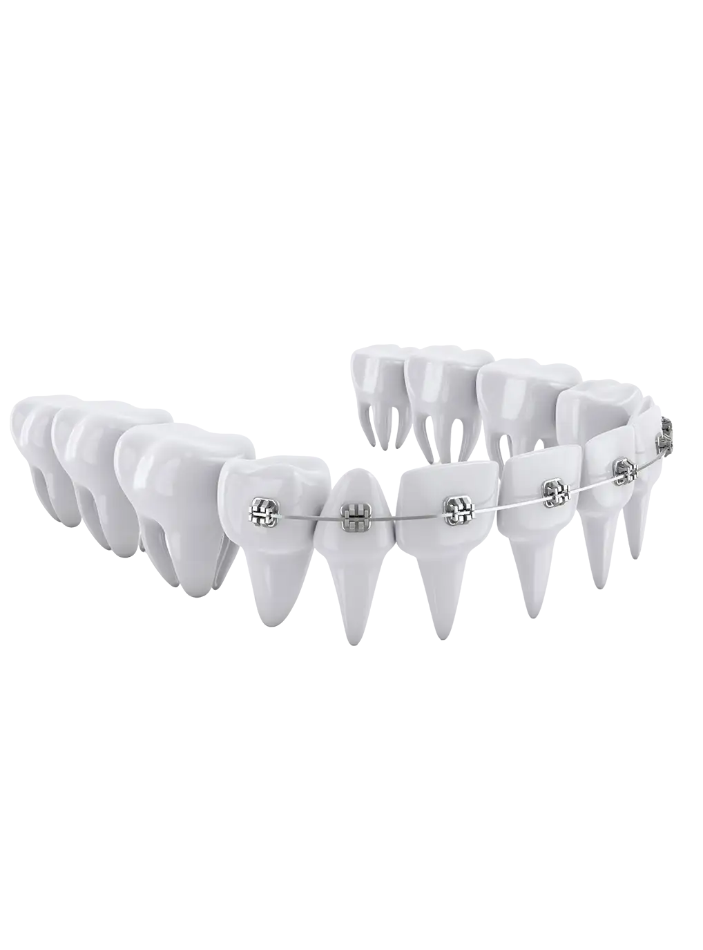 aparelho autoligado hok