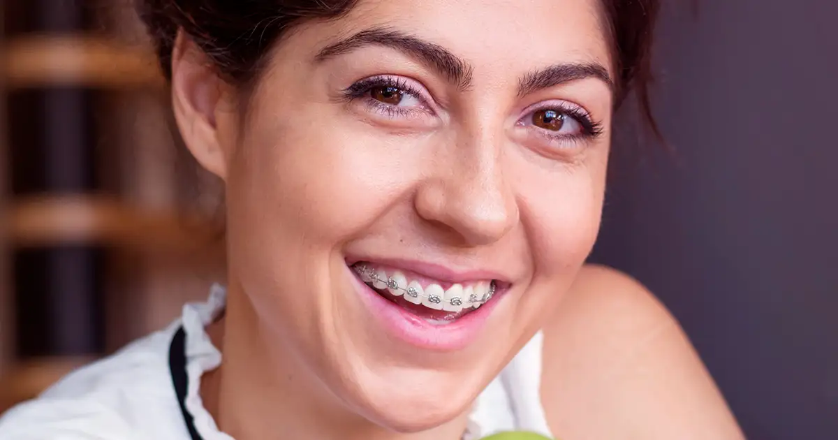 aparelho autoligado ortondontico