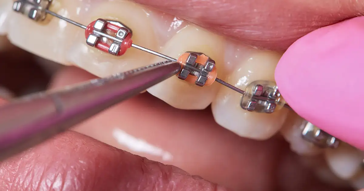 aparelhos tradicionais rio do sul