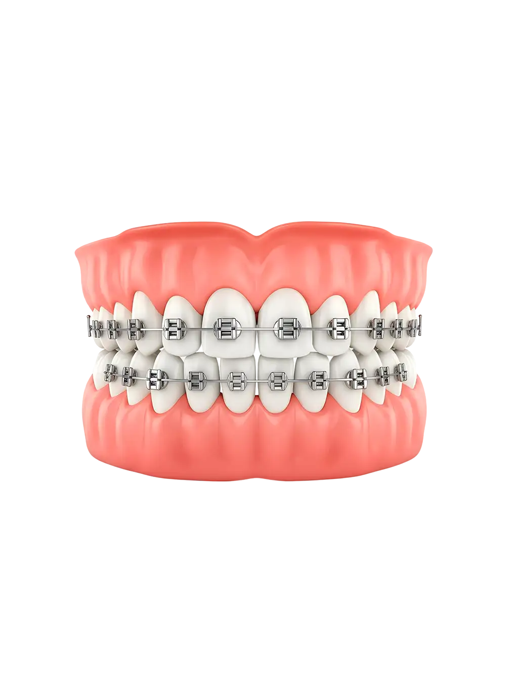 aparelhos tradicionais