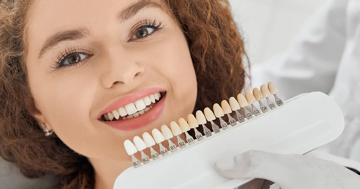 lentes de contato dental