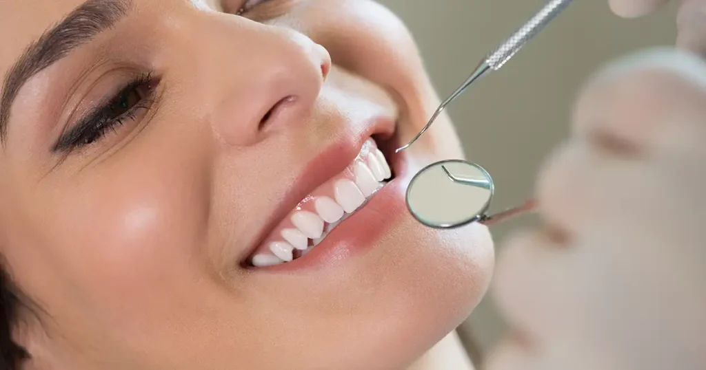 profilaxia limpeza dental