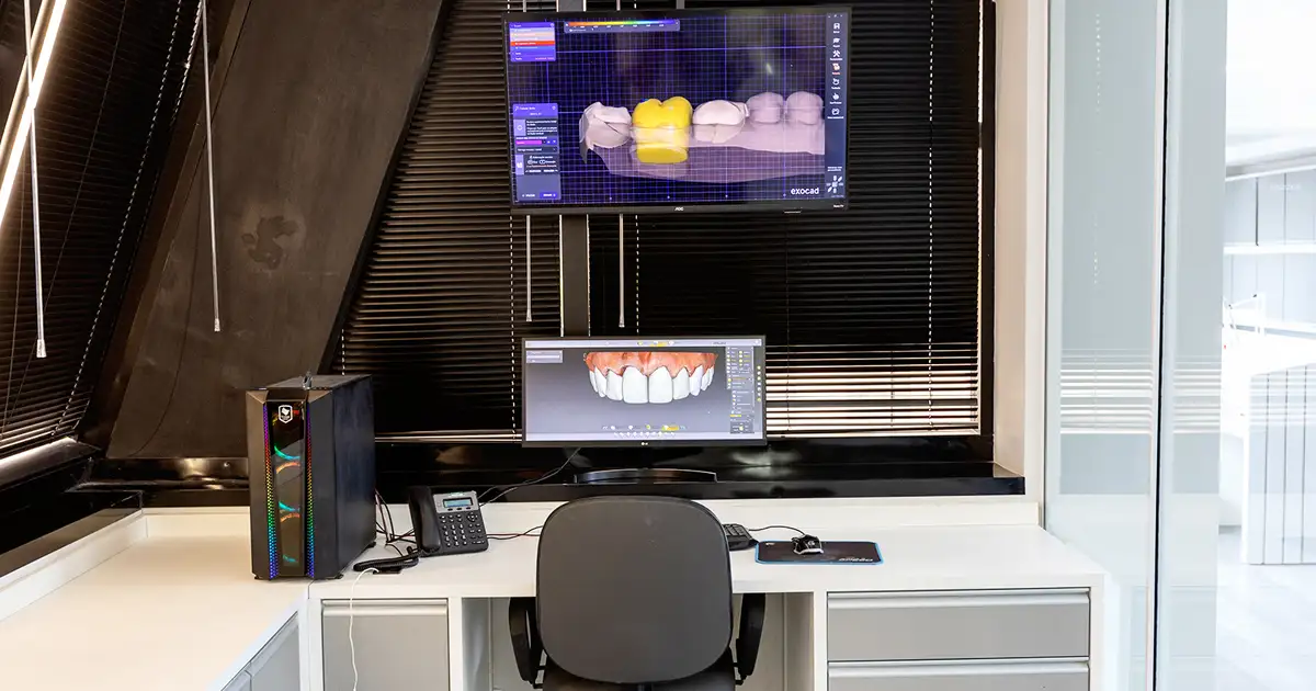 estrutura scanner 3d hospital kaufmann