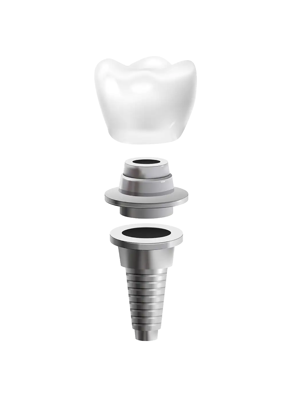 o que são os implantes dentários clinica de implantes hok